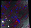 Auschnitt einer Memran unter dem Mikrospop: Fibroblasten (Bindegewebszellen) auf der elektroversponnenen Renacer-Membran unter dem Konfokalmikroskop (rot: Zytoskelett der Zellen, blau: Zellkerne).